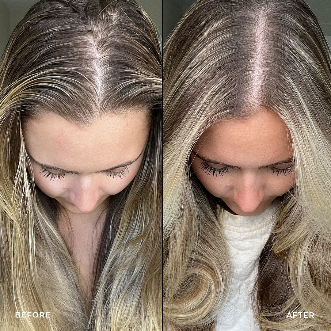 Results using the STRAAND scalp care system