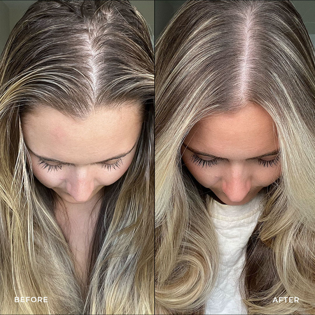 Results using the STRAAND system