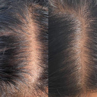 3 Step Scalp Soothe